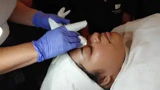 Pro Skin 30 - Extraction Demo