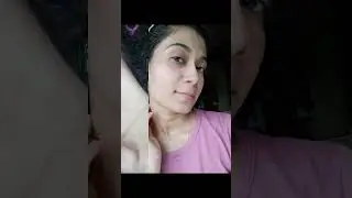My acne journey #acnestory #acne #clearskin