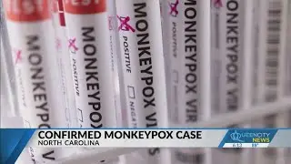 Confirmed monkeypox case in NC