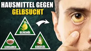 8 Nat&uuml;rliche Hausmittel gegen Gelbsucht