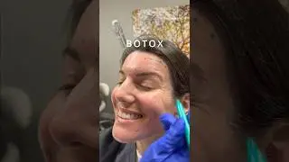 Get rid of crows feet, fine lines, and wrinkles with Botox at Wise Med Spa in Wayne, NJ!