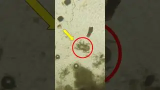 Look at maggi under microscope #shorts #ytshorts