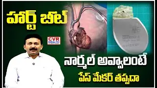 హార్ట్ బీట్ నార్మల్ అవ్వాలంటే పేస్ మేకర్ తప్పదా | Heart Pacemaker | CVR HEALTH