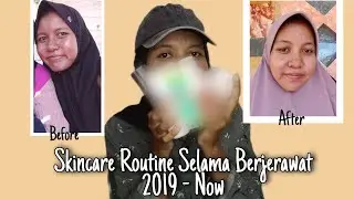Skincare Routine Aku Selama Pemakaian 2 Tahun! #AcneStory