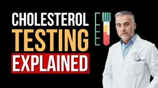 Cholesterol Testing Explained | The Perfect Time to Check Your Blood Cholesterol Levels
