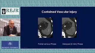THE ROLE OF CT IN ABDOMINAL TRAUMA