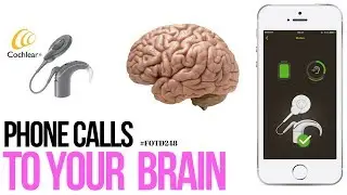 Phone calls straight to your brain - #FOTD244