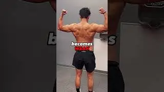 How to Fix Forward Head Posture & Rounded Shoulders