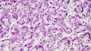 Stomach fundic portion in section filmed under microscope 400x on bright field