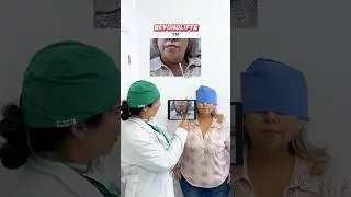 BeyondL&iacute;fte&trade; en Miami | Rejuvenecimiento Facial y Armonizaci&oacute;n Sin Cirug&iacute;a
