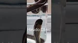 Medicinal leeches (Hirudo medicinalis) #Hirudotherapy