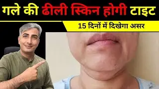 गले की ढीली स्किन होगी टाइट I 15 दिनों में दिखेगा असर  I DR. MANOJ DAS #drmanojdas #drmanojdasjaipur