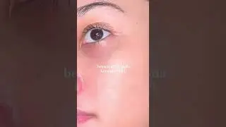 SERUM 20 RIBUAN SEMUA ATASI BRUNTUSAN +LINK PRODUK DISKON 50% FREEGIFT FREEONGKIR SHOPEE #SHORTS