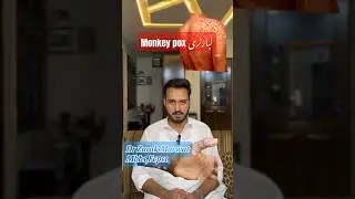 Monkey pox in pakistan | laboratory. #mpox #mpox2024 #monkeypoxtreatment #monkeypoxcase #virus
