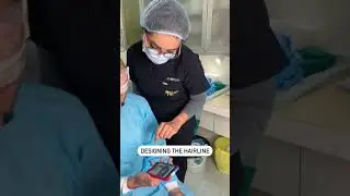 Hairline Designing in Hair Restoration | Dr Aman Dua - Best Hair Transplant Surgeon in Ludhiana