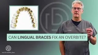 Can LINGUAL BRACES fix an overbite?