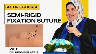 Semi rigid fixation suture for loose teeth || Dr. Nesma Elatris