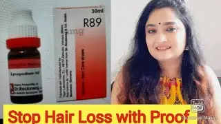 R89 results and honest review || best hair regrow and hair fall controller ?
