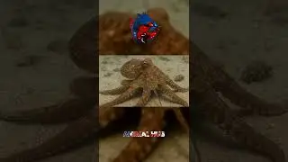 A brain unlike any other