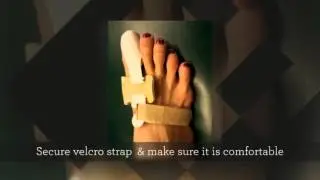 Bunion Night Splint Fitting Application