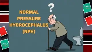 NORMAL PRESSURE HYDROCEPHALUS (NPH)