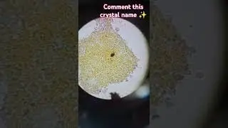 deposit ✨ microscopic examination#supportme#like and subscribe#comment this crystal name