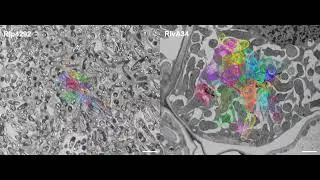 Nodule SBF SEM supplemental Video 1