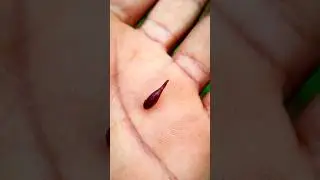 Leech on hand 😨 #shorts #leech #insects #acapella #seashanty #worms