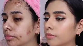 Como cubrir manchas de acne con maquillaje económicos? 2020👌  how to cover acne scars?
