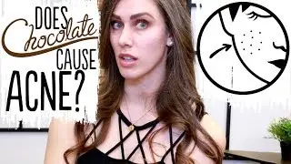 Does Chocolate ACTUALLY Cause Acne? FINALLY The Science Weighs In
