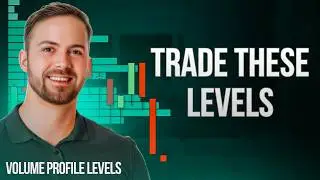 🎯 Top Volume Profile Levels to Trade This Week on USD/CAD, USD/JPY & USD/CHF