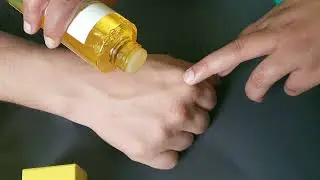 Some By Mi | Yuja Niacin Review | Get Updated Now