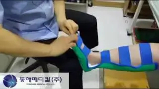 NEW Pre Mold SPLINT  SL영상시술(동해)