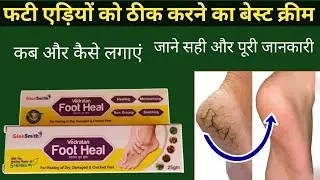 Crack cream | crack heal cream review | fati edi ki cream | फटी एडी कैसे ठीक करें | fati edi k cream