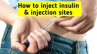 How to inject insulin & injection sites || #insulin #diabetes #insulininjections #diabetesmanagement