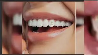 Gold tooth gems,stainless steel Halloween zombie tooth & Dental jewellery teeth art ideas part 2