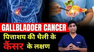 पित्ताशय की थैली के कैंसर के लक्षण | Gallbladder cancer | Gallbladder cancer symptoms | Dr Mustafa