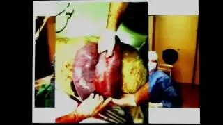Dr. PhD Julio Jim&eacute;nez, Intervenciones perinatales para modular el crecimiento pulmonar