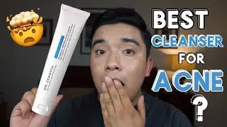 The Cleanser That CLEARED My Skin || Mottaskin