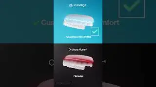 Invisalign | 5 Test Check - Comfort