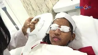 Skin Rejuvenation Laser Treatment | Photofacial @ ABC Clinic