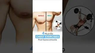 4 Must Do Chest Exercises After Gynecomastia Surgery #shortsvideo