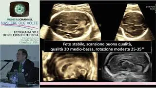 Il sistema nervoso centrale fetale