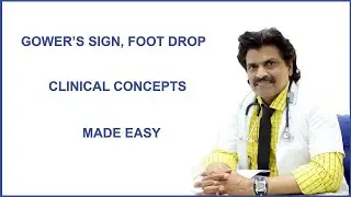 GOWER'S SIGN, FOOT DROP  CLINICAL CONCEPTS MADE EASY.