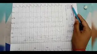 LDA 16- bit address| Microprocessor 8085 instruction