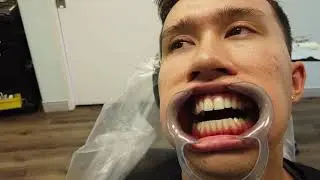 Copyrighted Video Training Dental Oral Clinical Photography by Dr. Charles Zahedi