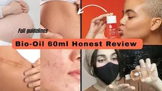Bio-Oil Skincare Oil 60ml Review | Does It Work? Pros, Cons . HONEST Detailed Review! 