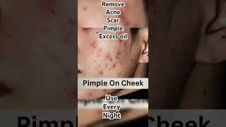 FACECLIN GEL||#Pimple#Acne#Scar#Blackheads#Whiteheads#medicine_knowledge