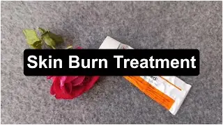Skin Burn Treatment | Skin Burn From Hot water, Direct Fire 🔥, Acid Or From Anything