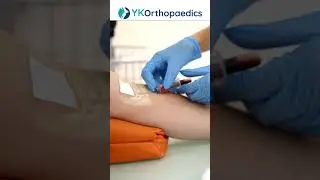 Unveiling the Healing Power of PRP Injections for Joint Problems